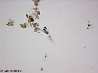 phyto/Thau_Lagoon/THAU_station1/OSU_plancton 2014/Rhopalodia gibberula (030214_Pennee2180515_001_ovl-3).tif(copy)_thumb.jpg